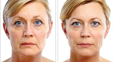 How can injectables help with the Sad, Tired & Saggy look that comes with Aging - MD Aesthetics