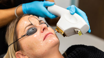 Not all lasers are created equal. Why Sciton Technology is a great choice for photofacials - MD Aesthetics