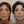 Load image into Gallery viewer, Dermal Filler Treatment in Whitby - MD Aesthetics