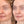 Load image into Gallery viewer, Vital II (Skin Boosting) Beauty Boost in Whitby - MD Aesthetics