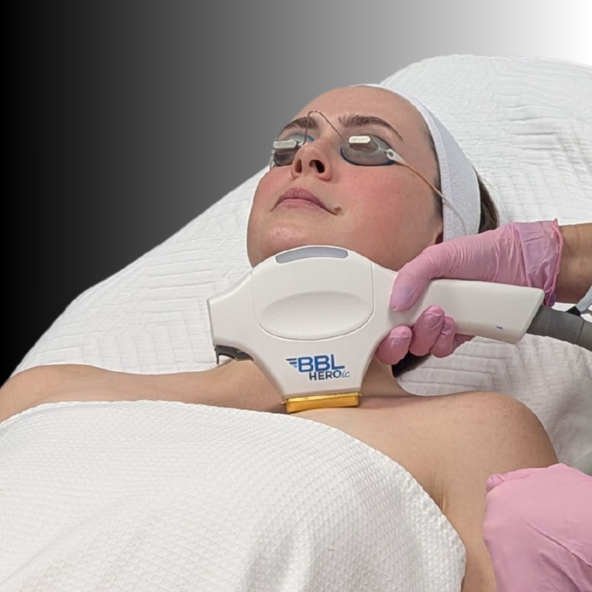 BBL Heroic Laser Treatment | MD Aesthetics