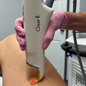 ClearV - MD Aesthetics