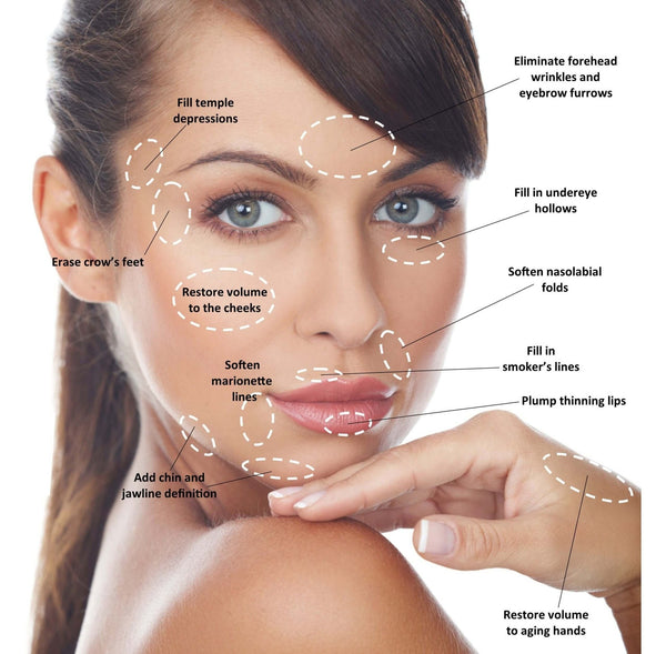 Dermal Filler Treatment in Whitby - MD Aesthetics