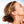 July Promo | SkinTyte® large area + Vivier - MD Aesthetics