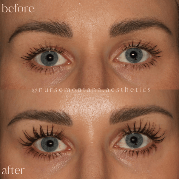 Lashes - MD Aesthetics