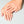Hands - MD Aesthetics