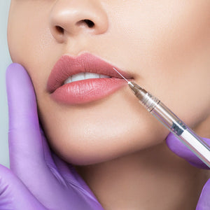 Lip Enhancement - MD Aesthetics